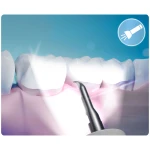 Skaler ultradźwiękowy do zębów 4 tryby do usuwania kamienia LED Berdsen BD-251